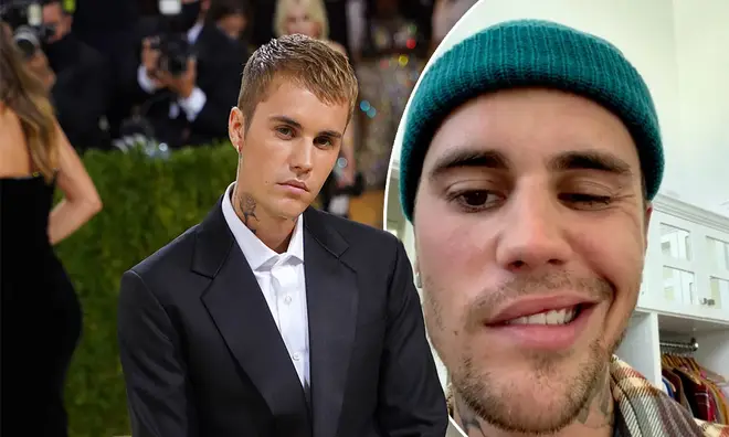 Justin Bieber has been struck by a virus which caused ‘full paralysis’ on one side of his face