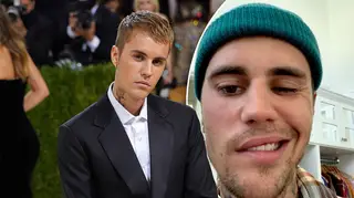 Justin Bieber has been struck by a virus which caused ‘full paralysis’ on one side of his face