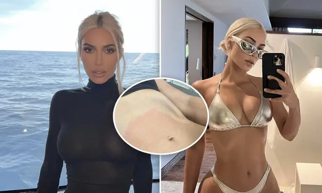 Kim Kardashian revealed she's undergone a 'painful' stomach tightening procedure