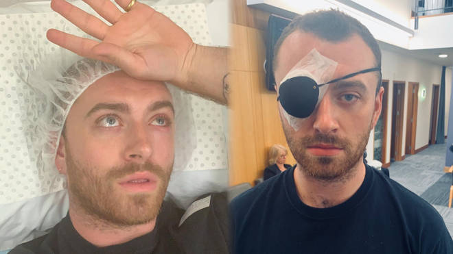 Sam Smith had an operation to remove a stye from his left eye