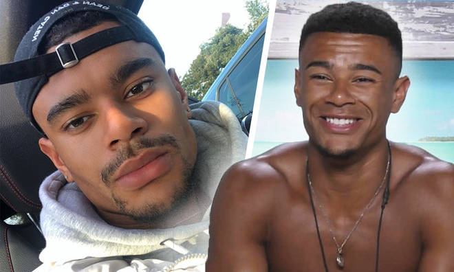 Wes Nelson's had botox fillers since leaving the Love Island villa