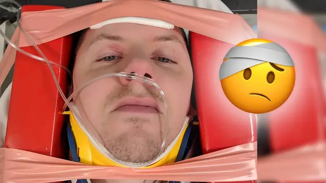 Professor Green suffered from a seizure resulting in a broken vertebrae