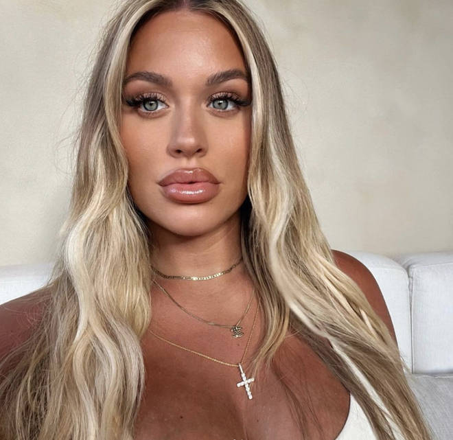 Lottie Tomlinson has decided to dissolve her lip and face fillers