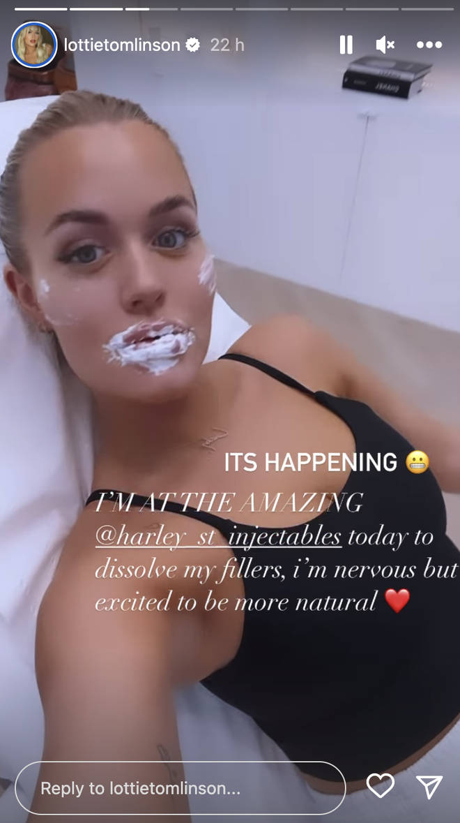 Lottie Tomlinson shared a candid post about dissolving her fillers