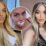 Lottie Tomlinson shared her new look after getting her fillers dissolved