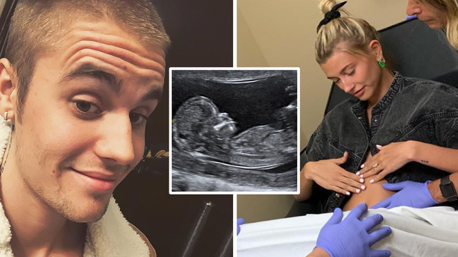 Justin Bieber has announced Hailey Baldwin is pregnant with their first baby