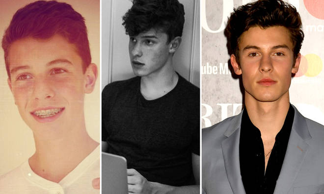 Shawn Mendes has come a long way since his brace-smile selfies