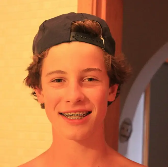 Shawn Mendes once had braces just like the rest of us