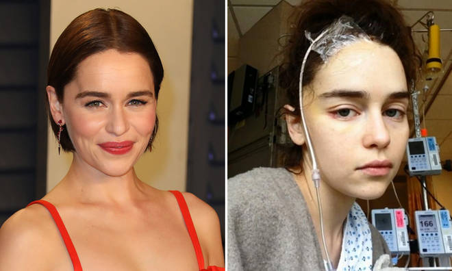 Emilia Clarke suffered two brain aneurysms at the age of 24