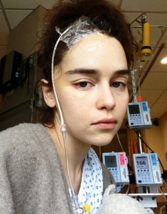 Emilia Clarke had to have excruciating brain surgery on the second aneurysm