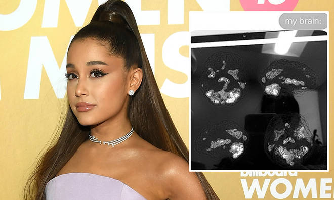 Ariana Grande shared the full extent the effects of the Manchester attack still has on her