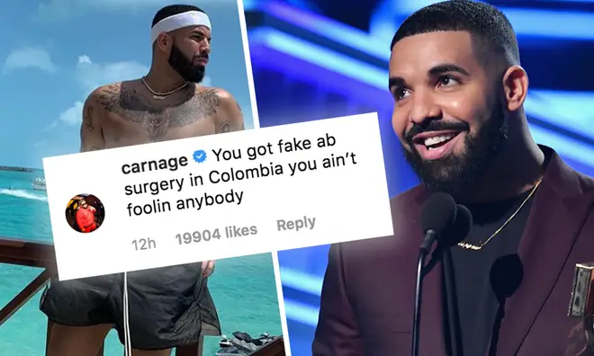 Drake's accused of getting fake abs by a close friend