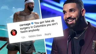 Drake's accused of getting fake abs by a close friend