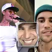 Justin Bieber has updated fans following his Ramsay Hunt syndrome diagnosis