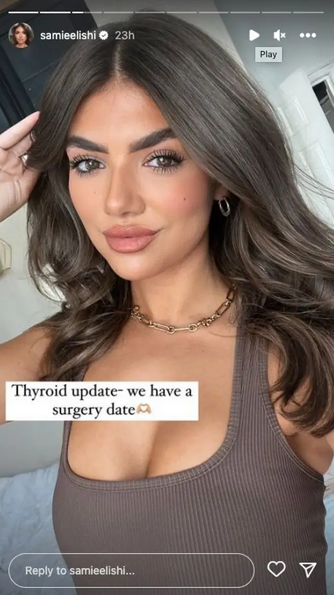 Samie Elishi has a date set to have the lump on her neck removed