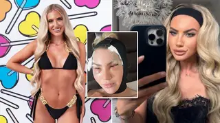 Love Island's Mollie Salmon looked unrecognisable after undergoing fox eye lift surgery