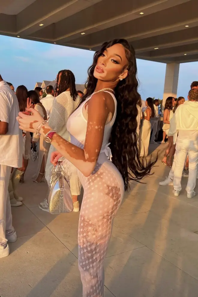 Winnie Harlow attended the white party hosted by Michael Rubin