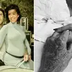 Kourtney Kardashian had to undergo emergency fetal surgery