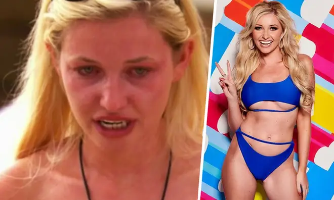 Amy Hart has revealed she was forced to eat during Love Island heartbreak