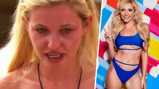 Amy Hart has revealed she was forced to eat during Love Island heartbreak