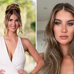 MAFS star Lauren has spoken about getting fillers and botox