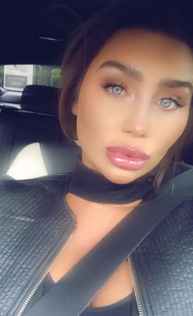 Lauren Goodger has been open about having lip filler