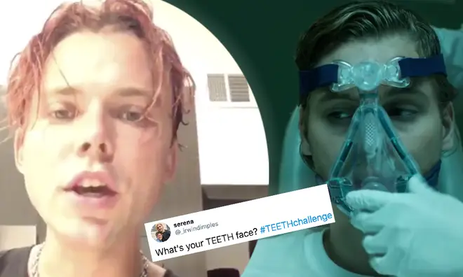 5SOS join in on fan's 'Teeth challenge'