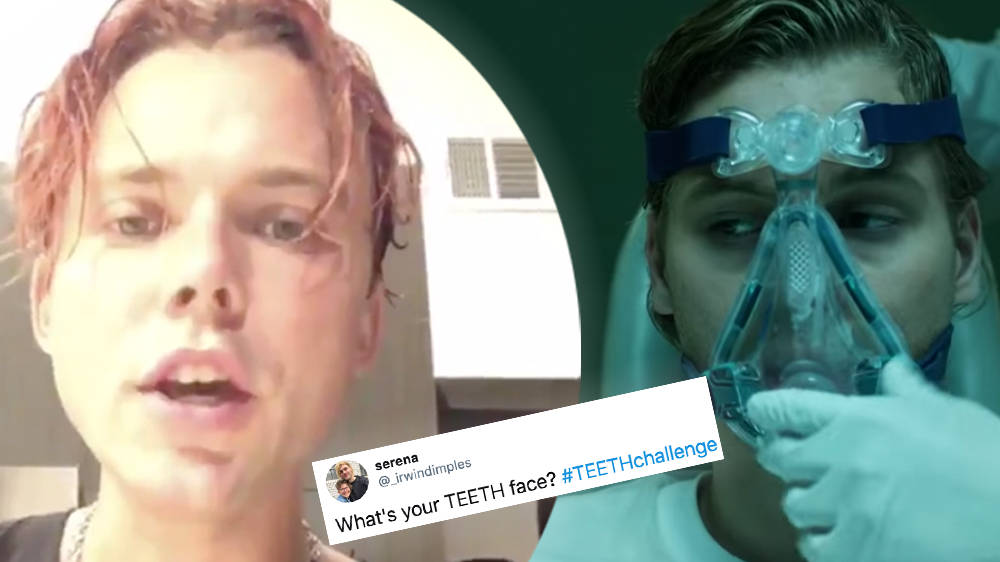 5sos Have Taken Part In The Teeth Challenge Fans Have Voted