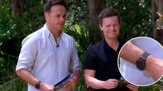 Fans noticed Ant and Dec's watches were covered on I'm A Celebrity...